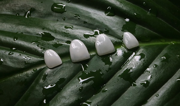How To Prevent Stains On Dental Veneers