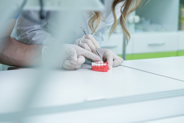 Questions To Ask A Dentist Before Getting Dentures